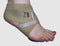 Fabrifoam PSC (The Pronation/Spring Control device)