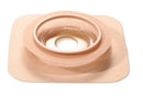 Convatec Natura™ Moldable Stomahesive Skin Barrier with Accordion Flange