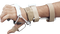 DeRoyal LMB™ Radial Nerve Splint Wrist Extension