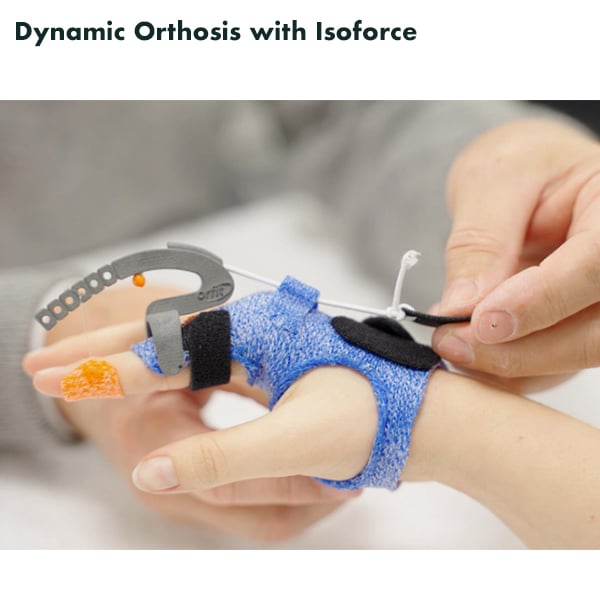 North Coast Medical Isoforce Outrigger System